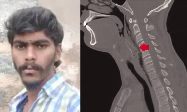 Man dies after swallowing fish for TikTok video